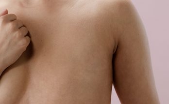 Sore Nipples